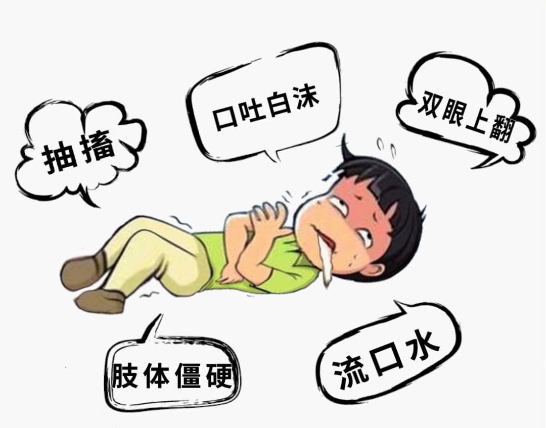 急救科普 | 癫痫的现场处理