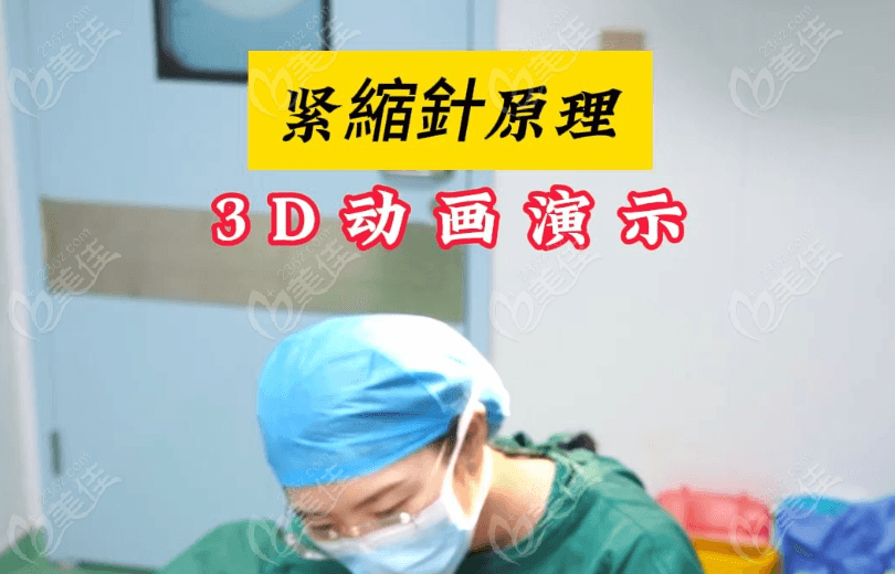 紧缩针是骗局吗？正规医院打紧缩针是真的不是骗局|能维持3-5年