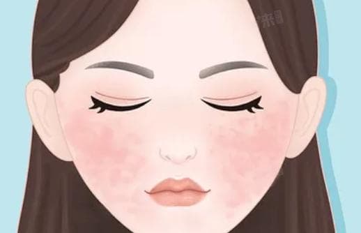 脸容易红怎么解决