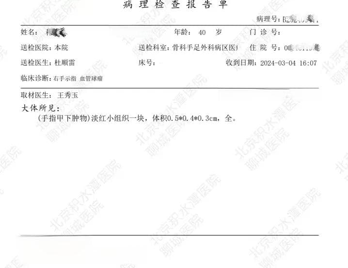 别碰我！—有一种痛叫“甲下血管球瘤”