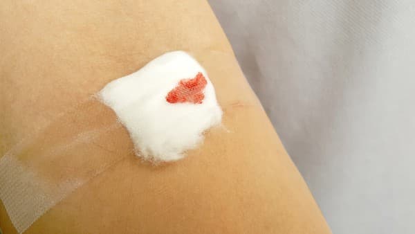 蝎子油的功能与主治作用有哪些