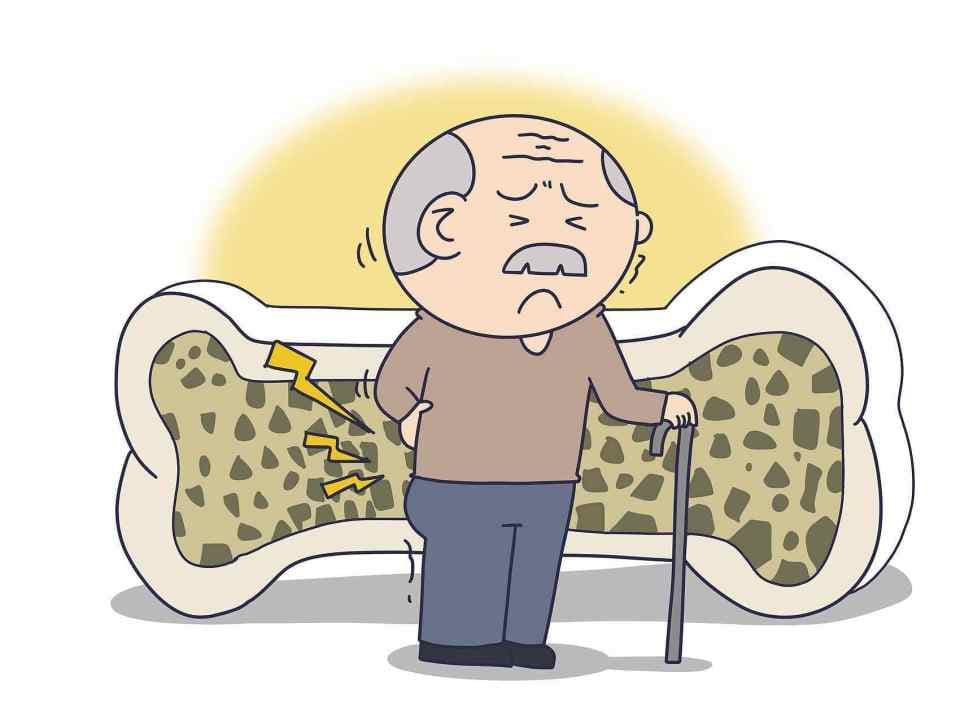 “良药”成“凶手”！十年胃药让她的骨头老了十岁