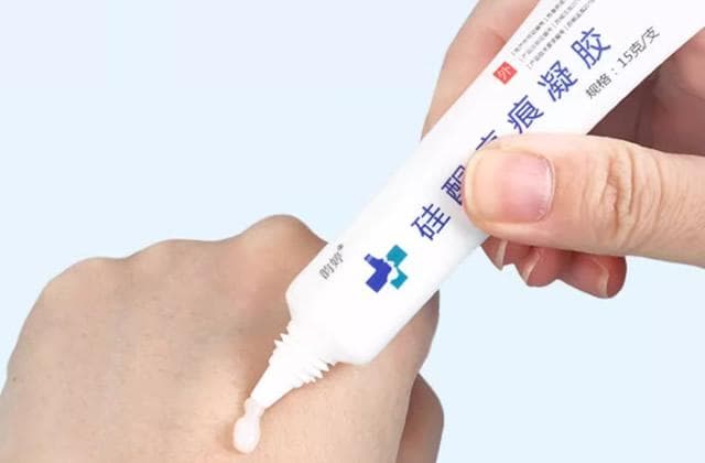 硅酮凝胶祛疤效果好吗？作用与功效全解析