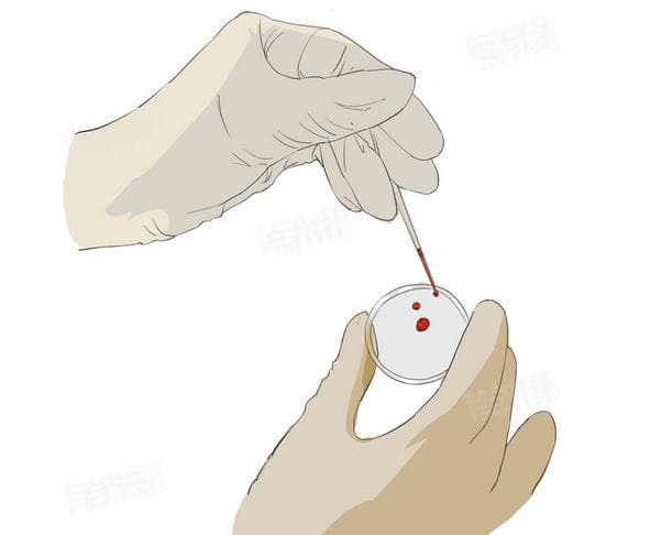 血型分类：ABO与Rh系统的区别及临床意义