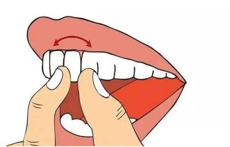 牙齿松动怎么办？不止拔牙一条路！