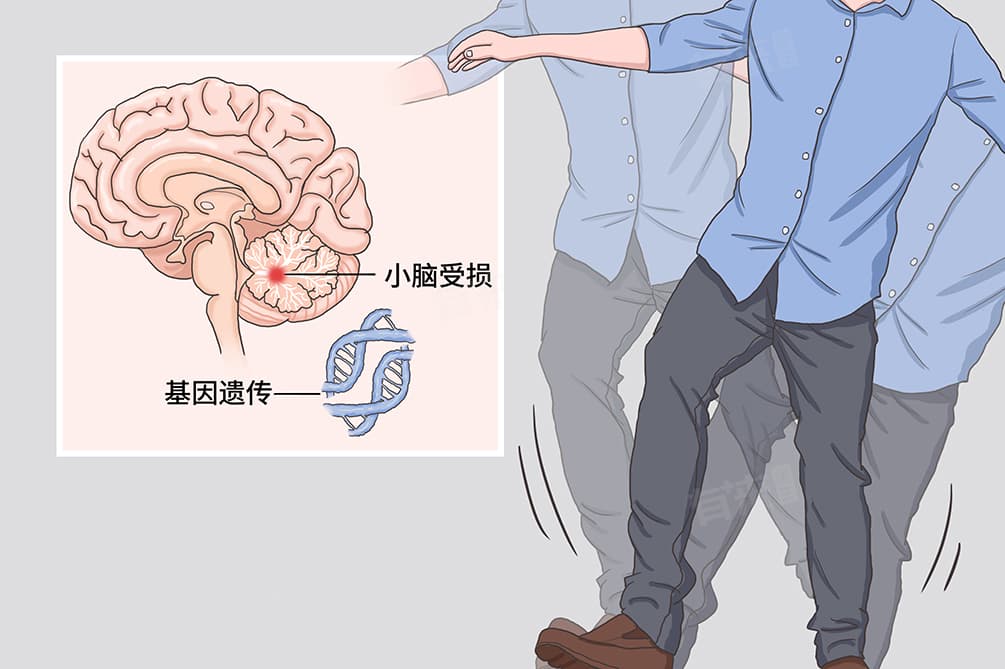 共济失调的症状
