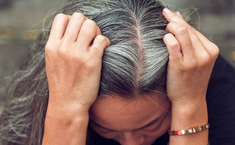白发成因及位置由中西医详解｜多吃这些维生素及食物有助改善白发