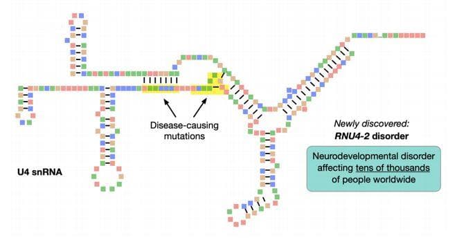 最新Nature Medicine：罕见基因突变，导致智力低下