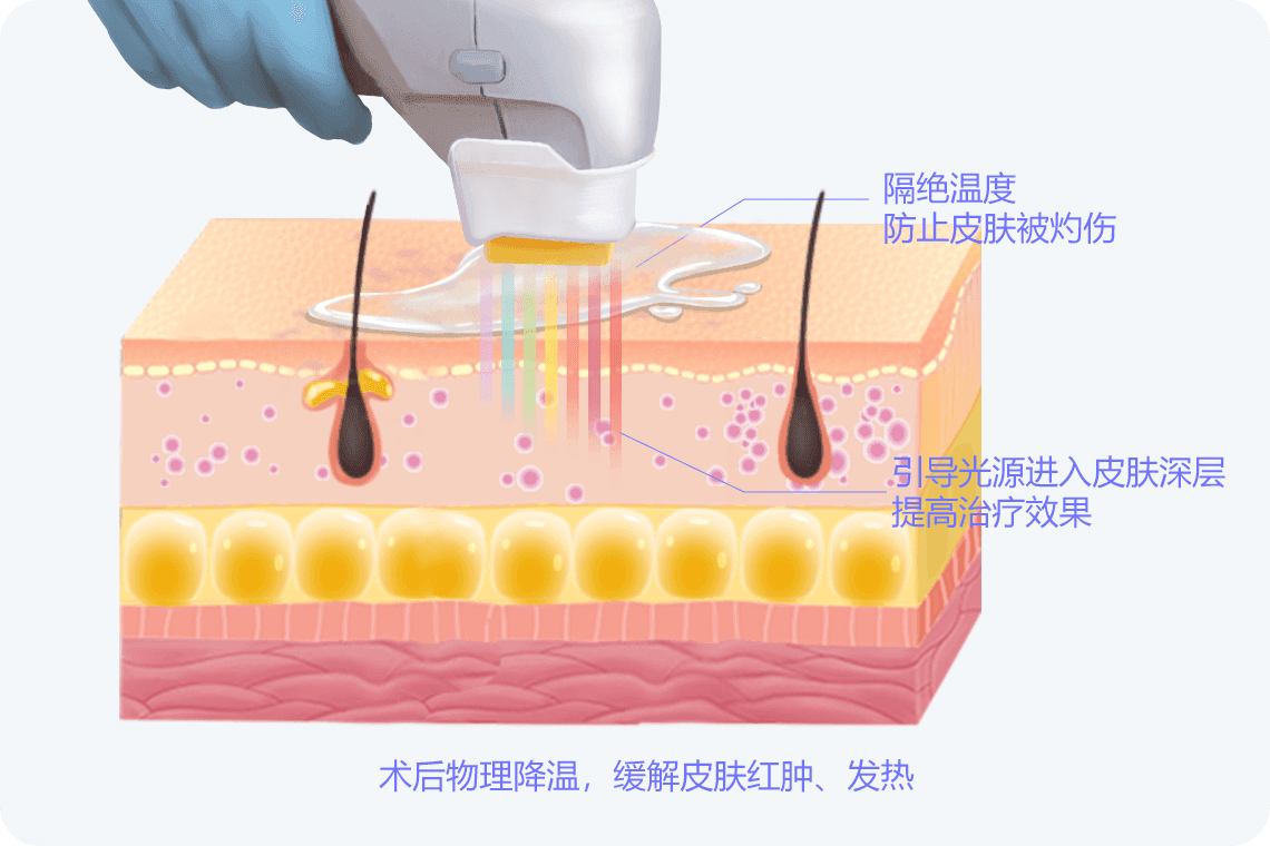 导光凝胶是干什么用的