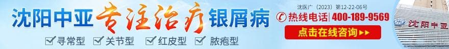 银屑病如何检测？一文详解五大诊断方法