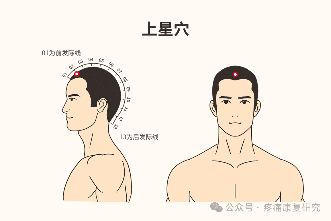 十三鬼穴：中医针灸里的特殊穴位组合