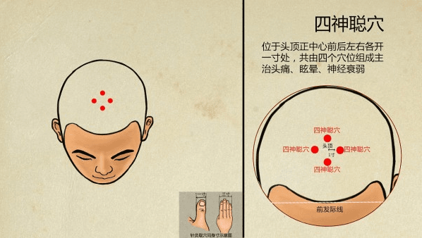 《春醒脑力·三穴防健忘》—— 中年脑雾破解术