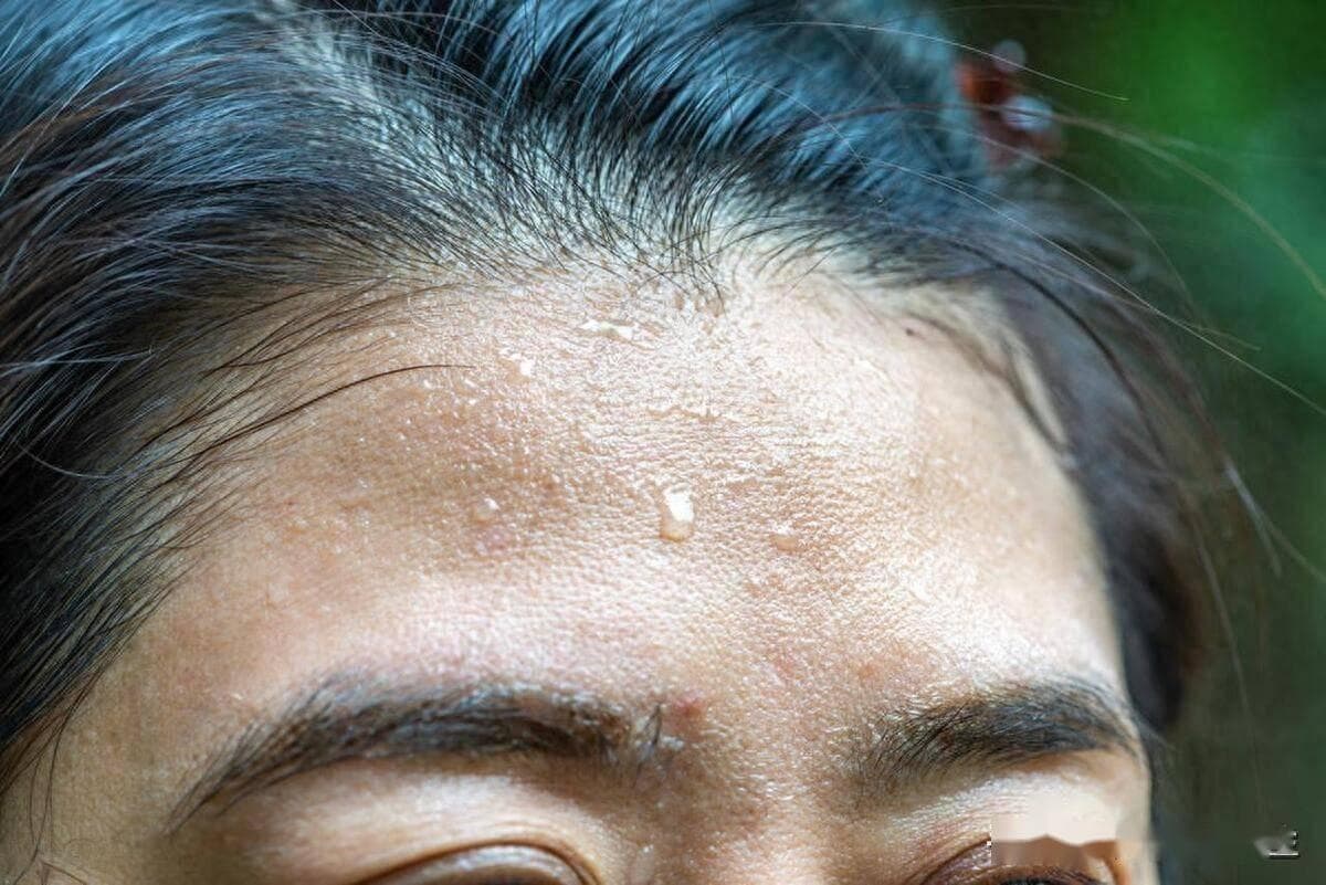 白天“自汗”和晚上“盗汗”，哪一个对身体影响更大？中医告诉你