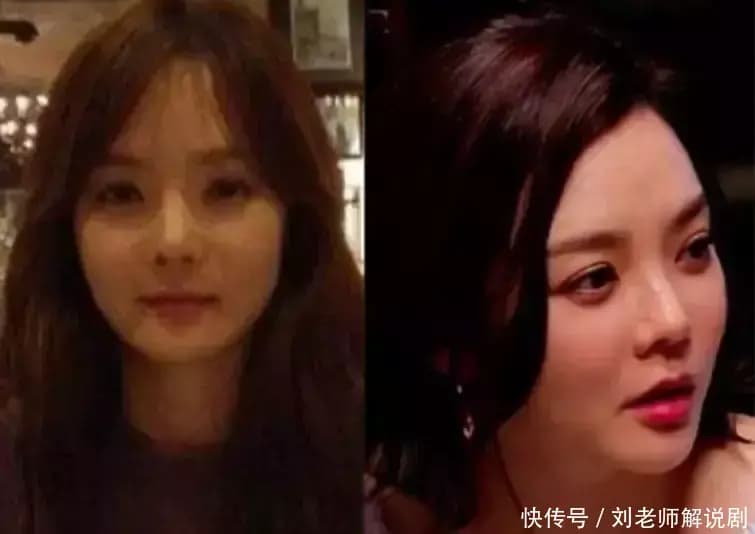 蔡琳：从整容自卑到自信女王的蜕变之路