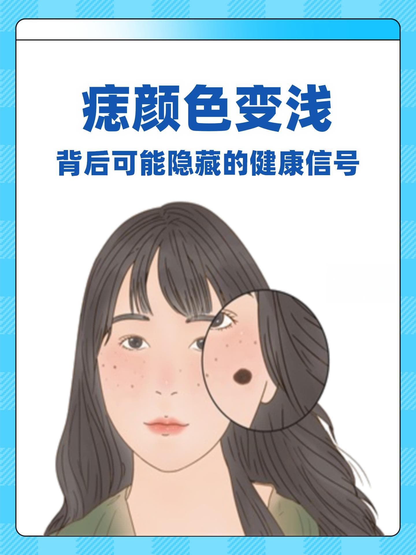 痣颜色变浅，背后可能隐藏的健康信号