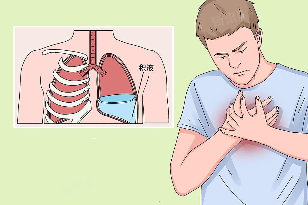 肺部术后积液怎么消除