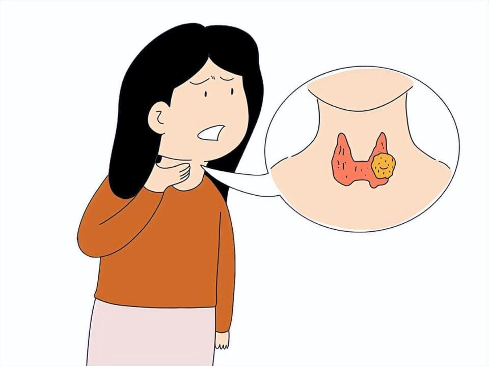 甲状腺结节患者如何克服心理障碍？