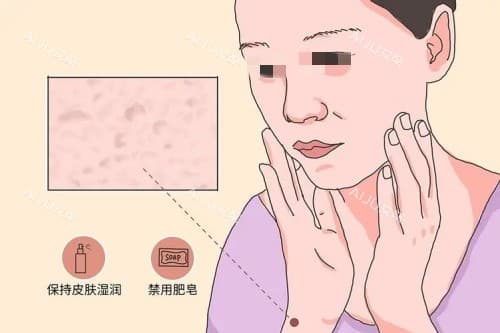 医美怎么消除角质层薄？探究角质层薄的原因，分享五种角质层薄修复的方式