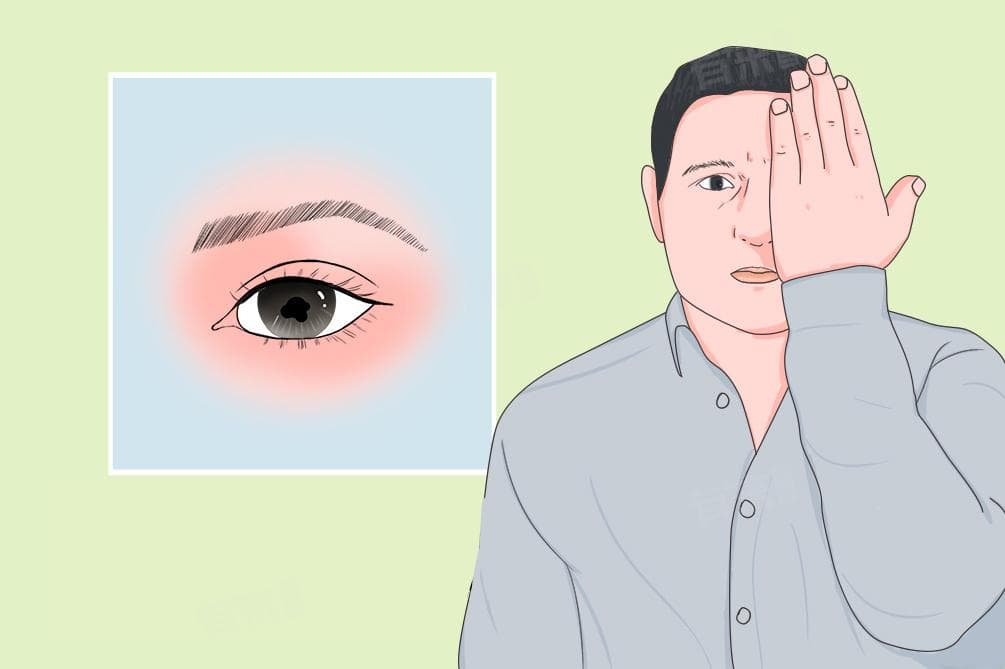 瞳孔收缩代表什么