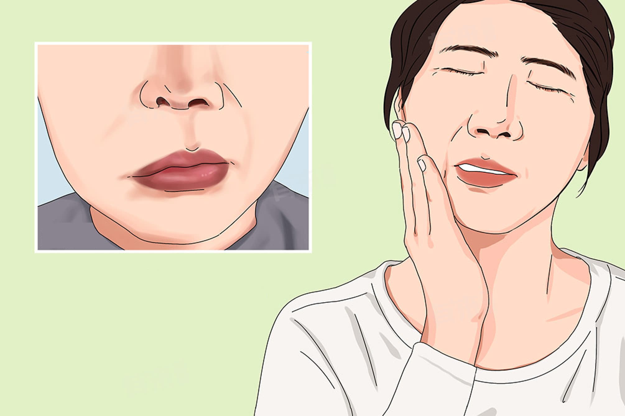 脸上发麻是怎么回事