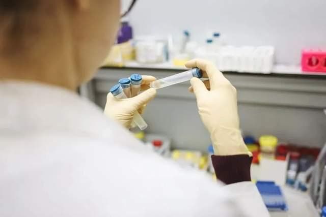 什么是HIV病毒载量检测？病毒载量检测有什么作用？