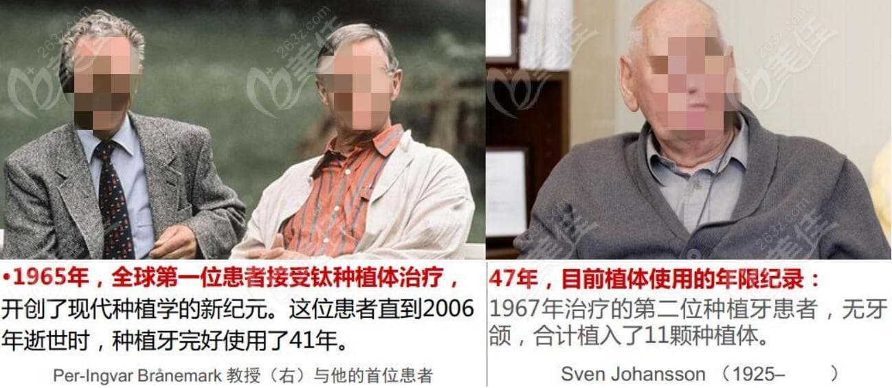 韩国登腾纯钛种植牙质量怎么样？五年使用体验告诉你答案