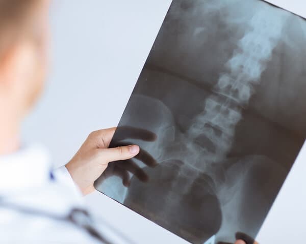 经常起床后腰椎疼痛、该怎么检查才准确