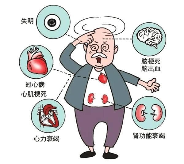 高血压只减盐就可以吗？做到这些更重要