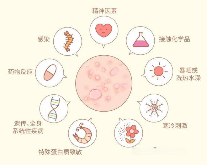 得了痒死人的荨麻疹，还能洗澡吗？能晒太阳吗？一文全解答咯