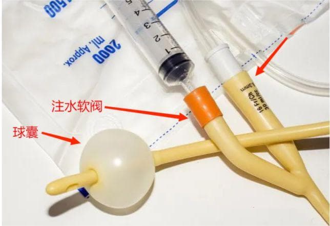 拔尿管时多做一步，患者再也不觉得疼！还有很多护士不知道~