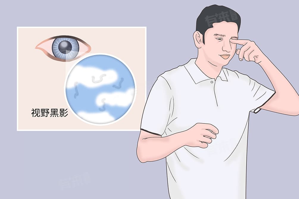为什么会有飞蚊症症状