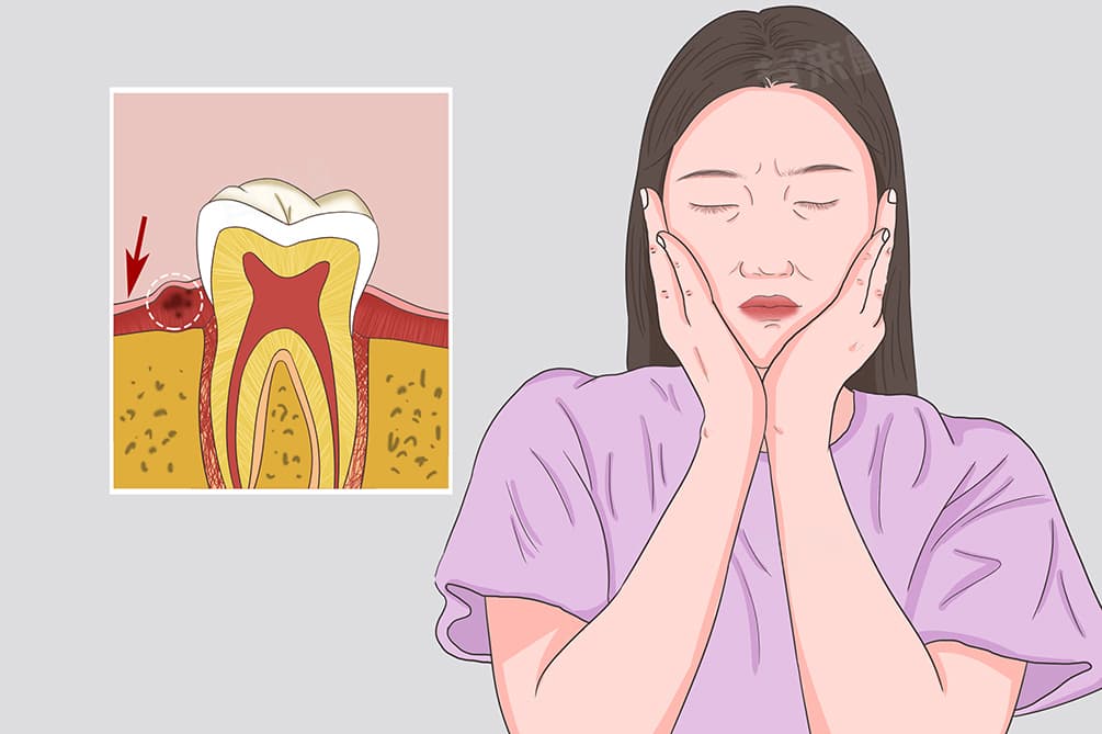 牙龈肿疼怎么办