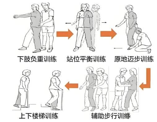 脑卒中后下肢功能康复训练的重要性与建议