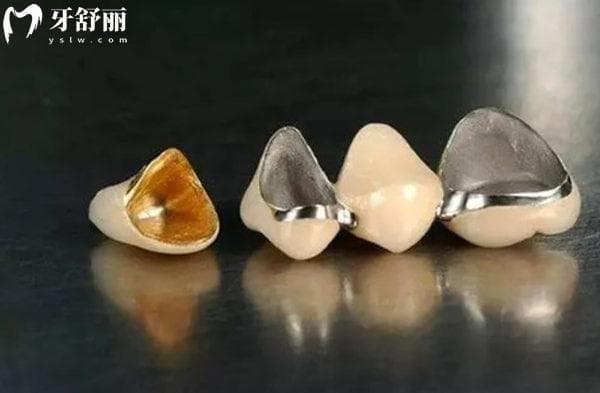 镶牙真的不能做核磁共振了吗?get镶牙什么材质的不影响做核磁？