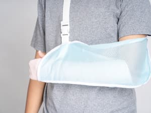 骨折后的“冷血杀手”——骨筋膜室综合征