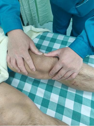 “跑步膝”康复训练：缓解髌骨疼痛的方法