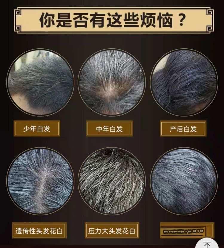 如何有效预防白发产生、解决白发问题?