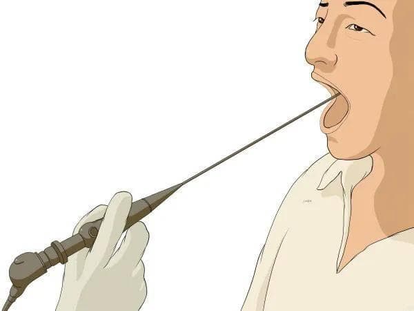 北京协和医院专家：这些情况下必须做喉镜检查