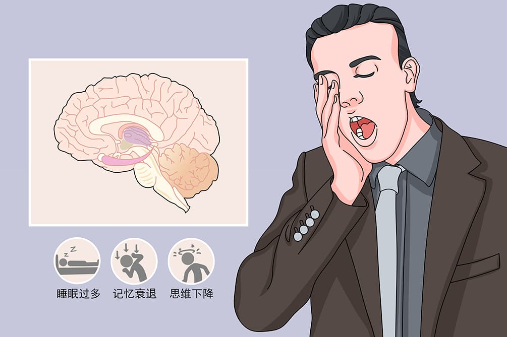 嗜睡症的表现症状