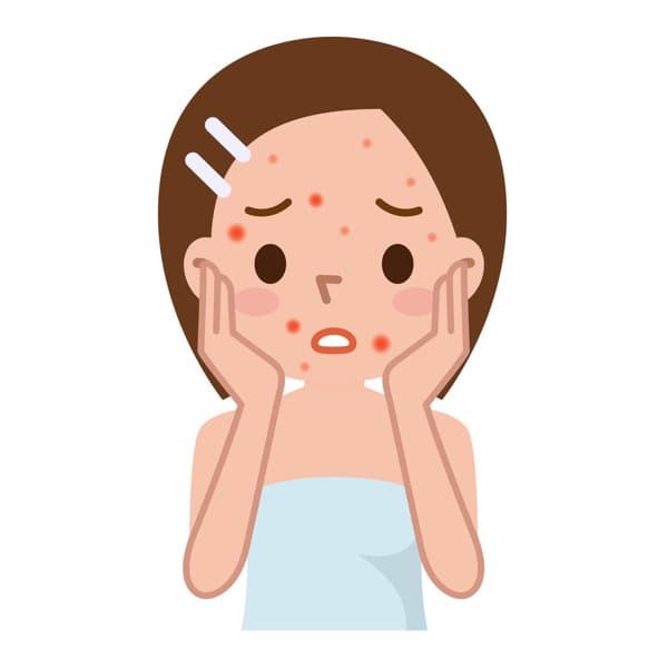 扁平疣治疗方法