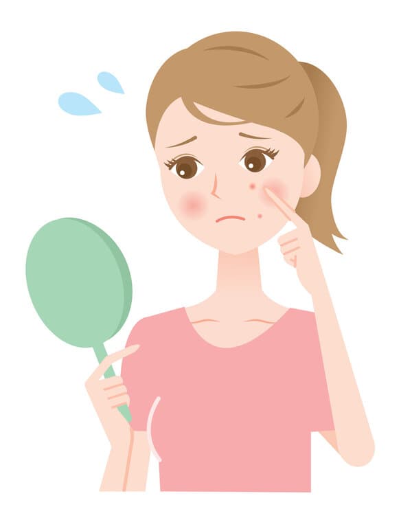 痤疮的病因及治疗原则有哪些