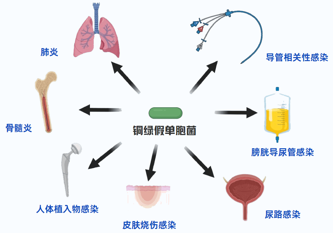 病原科普丨认识最“熟悉”的“陌生菌”：铜绿假单胞菌