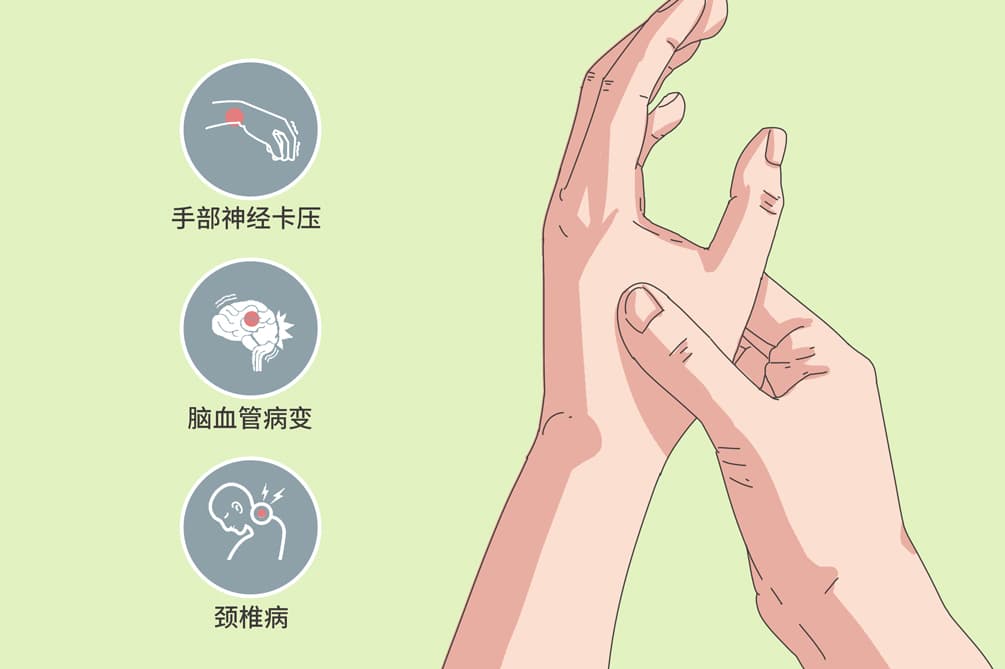 手麻做什么检查合适
