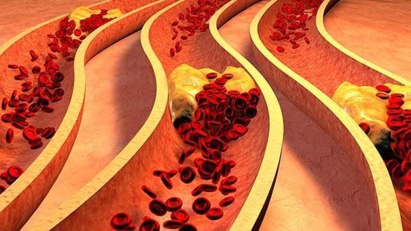 从膳食纤维到Omega-3：六种食物助力肠癌患者防复发