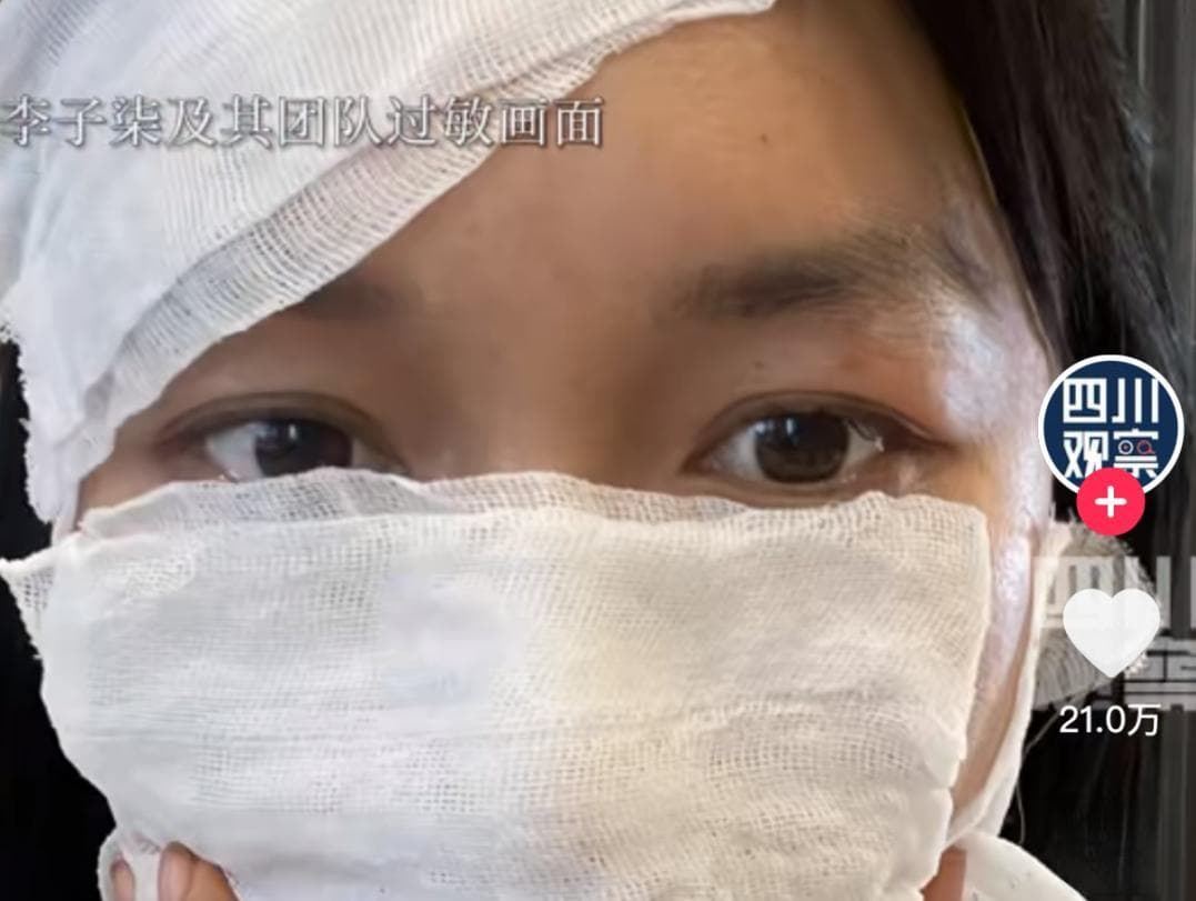 让李子柒严重过敏的物质，是你买不到带壳腰果的原因