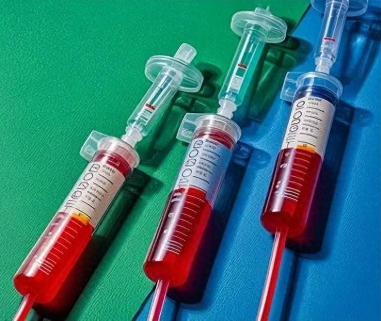 为什么AB型血叫做贵族血？提醒：AB型血的人或有5个缺点，多留意