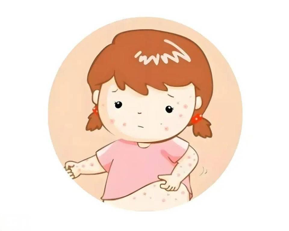 冬季儿童注意预防水痘，远离3个传播途径，及时治疗，做好护理