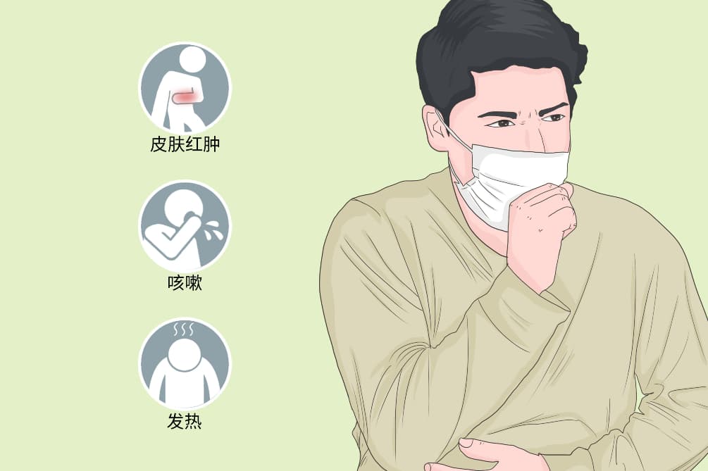 诺卡菌病：症状、诊断与治疗全解析