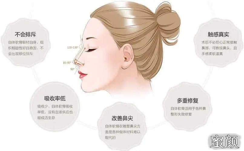 鼻整形：肋软骨VS其他材料，哪个更适合你？