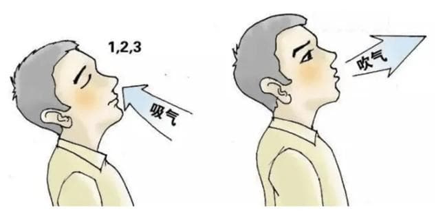 世界慢阻肺病日丨慢阻肺康复运动，轻松呼吸不是梦